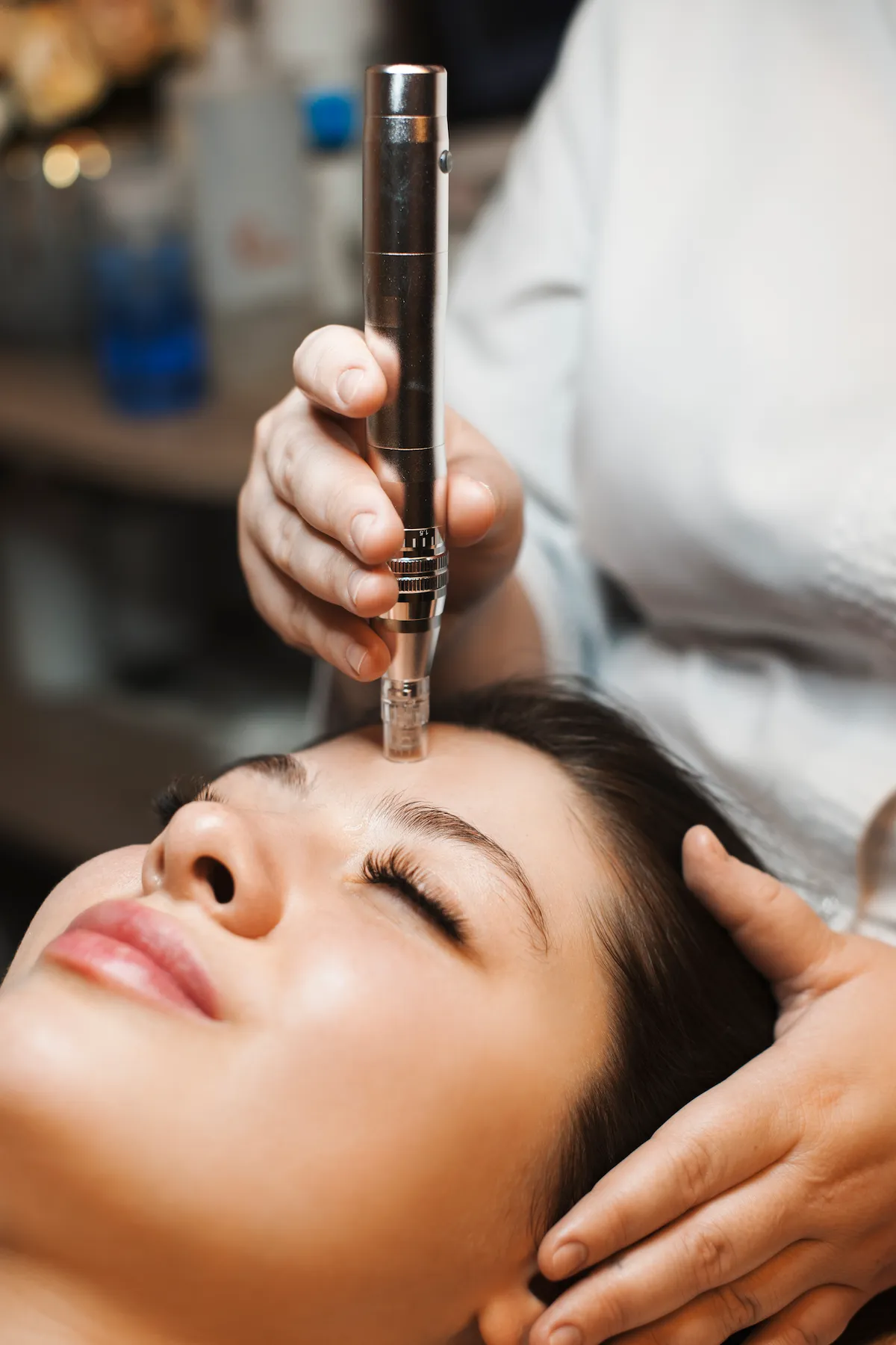 A microneedling pen gliding across a guest's cheek during a collagen-induction treatment