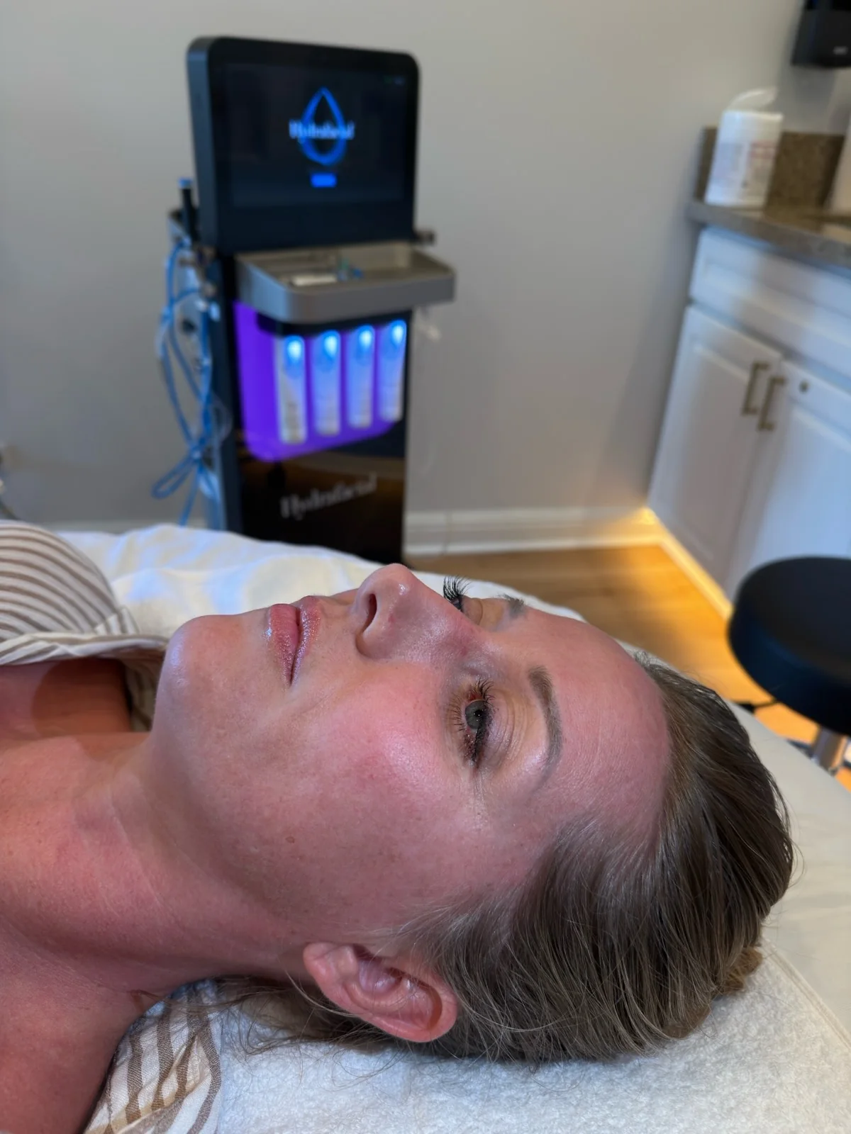 Guest resting on the treatment bed beside the HydraFacial device mid-session